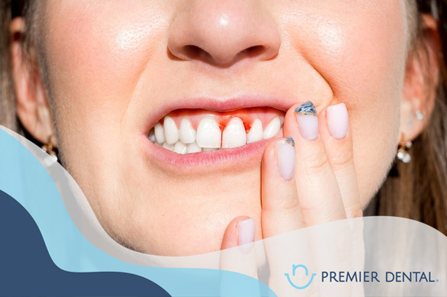 bệnh răng miệng phổ biến cần biết