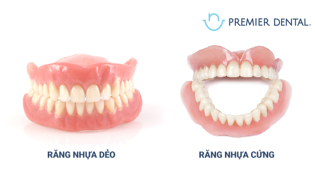 Răng nhựa cứng hay răng nhựa dẻo tốt hơn